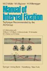 Manual of Internal Fixation: Technique Recommended by the AO-Group Swiss Association for the Study of Internal Fixation: ASIF